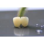 3D Print Framework PFM Dental Lab Crown For Dentistry for sale