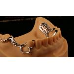 Upper Cast Metal Framework Partial Dentures Strong Lightweight And Durable