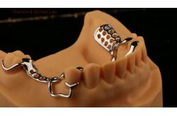 China Upper Cast Metal Framework Partial Dentures Strong Lightweight And Durable supplier