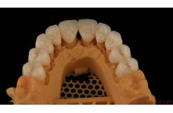 China Full Contour Dental Lab Crowns High Translucency Solid Zirconia Crown China Dental Lab supplier