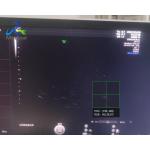 GE Voluson E8 Ultrasound Machine Repair Abnormal Ultrasound Images Replace Rfm Board
