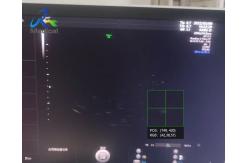 China GE Voluson E8 Ultrasound Machine Repair Abnormal Ultrasound Images Replace Rfm Board supplier