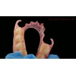 Dental TCS Valplast Flexible Partial Dentures Dental Lab 3D Print Model High Esthetics for sale