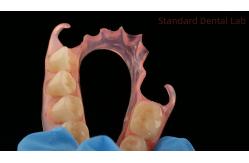 China Dental TCS Valplast Flexible Partial Dentures Dental Lab 3D Print Model High Esthetics supplier