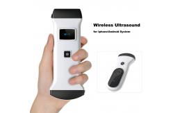 China Real-Time Skin/Fat Imaging | WiFi Cloud-Enabled Handheld Ultrasound supplier