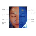 45W Power Smart Skin Analyzer Machine PDF Print for Doctor Beauty Salon for sale