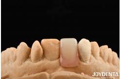 China High Stealth Good Elasticity Flexible Denture Finish For Diverse Manufacturing Processes supplier