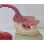China Custom Denture Impression Trays manufacturer