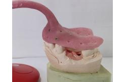 China Custom Denture Impression Trays supplier