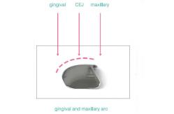 China Sectional Matrix Band Dental Use In Teeth M2 supplier
