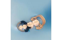 China Zt Dental Sectional Matrix System Dentistry Sectional Matrix Clamp Ring R6 1.0 supplier