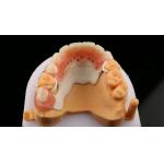 Peek Partial Framework Design ISO CE And FDA Dental Lab Acrylic Partial Denture Framework for sale