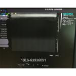 Acuson 18L6 HD Linear Ultrasound Scanner Probe Sonography Goods