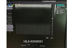China Acuson 18L6 HD Linear Ultrasound Scanner Probe Sonography Goods supplier