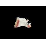 High Quality Comfortable Partial Denture With HPP Framework Restores Chewing And Speaking Ability for sale