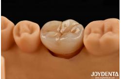 China Natural-looking Multilayer Full Zirconia For High Strength And Durability supplier
