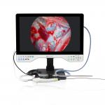 TUYOU 1080P Multi-Functional Rigid And Flexible Endoscope Camera System For Laparoscopy for sale