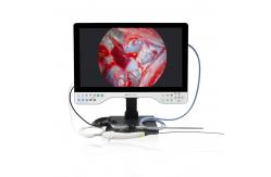 China TUYOU 1080P Multi-Functional Rigid And Flexible Endoscope Camera System For Laparoscopy supplier