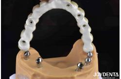 China High Strength Ti-Base Hybrid Zirconia Bridge Fracture Resistance Dental Solution supplier
