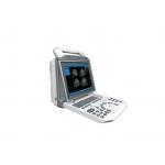 SUCE-I50 12.1'' Digital Ultrasound machine for sale