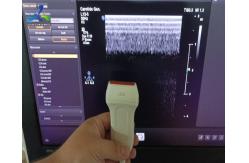 China  EPIQ Ultrsaound Machine Repair Version A ACQ Ultrasound Board supplier