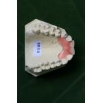 Flexible Invisible Denture