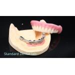 Titanium Implant Supported Dentures Precise Ivoclar Denture Over Implants for sale