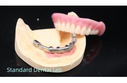China Titanium Implant Supported Dentures Precise Ivoclar Denture Over Implants supplier