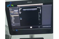 China EPIQ 7 Ultrasound Machine Repair Screen Abnormal Vertical Stripes supplier