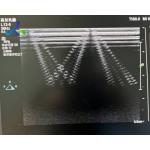  EPIQ 5 Ultrasound Machine Repair All Probe Images Are Abnormal Replace ACQ for sale