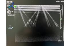 China  EPIQ 5 Ultrasound Machine Repair All Probe Images Are Abnormal Replace ACQ supplier