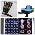 High Image Stability Medical X Ray Films 210 Microns Blue Substitute Fuji Film
