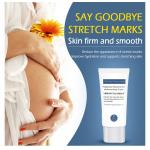 Stretch Mark Repair Cream postpartum stretch mark remove weight gain marks  moisturizing cream for sale