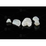 Translucent Onlay Zirconia Inlay For Long Lasting Stain And Wear Resistance for sale
