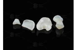 China Translucent Onlay Zirconia Inlay For Long Lasting Stain And Wear Resistance supplier