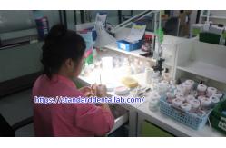 China Dental PFM Crown manufacturer