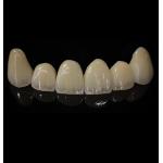 Comfortable Zirconia Crown With Good Fitting And Precision Esthetics for sale