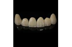 China Comfortable Zirconia Crown With Good Fitting And Precision Esthetics supplier