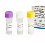 Infertility Diagnosis MAR IgG Kit For Determination IgG Antibody Coating Of Spermatozoa for sale