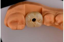 China Oral Implantology Self Tapping Single Tooth Dental Implants With Internal Hex Connection supplier
