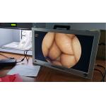 Full HD 1080P 4 In 1 One Integrated Portable Medical Endoscope Camera System for sale