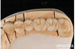China White Full Zirconia With High Resistance To Thermal Shock High Strength supplier