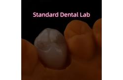 China Crown All Porcelain Ceramic Zirconia Ivoclar Esthetic Teeth OEM supplier