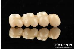 China Ultra-precision processing Zirconia Implants All-Zirconium Integrated Crown supplier