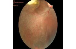 China 35mm Fundus Imaging System Equipment Auto Focus Shooting supplier