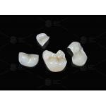 Translucent Onlay Zirconia Inlay For Long Lasting Stain And Wear Resistance