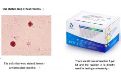 China Semen Leukocytes Test Kit Peroxidase Staining 40T/Kit Sperm Function Test Kit supplier