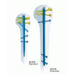 Surgical Orthopedics Anatomic Humerus Interlocking Nail for sale