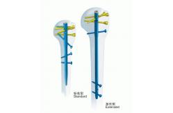 China Surgical Orthopedics Anatomic Humerus Interlocking Nail supplier