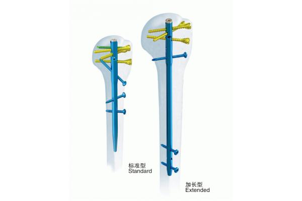 Surgical Orthopedics Anatomic Humerus Interlocking Nail